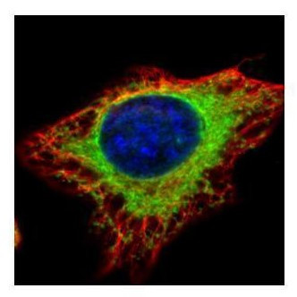 GANAB Antibody in Immunocytochemistry (ICC/IF)