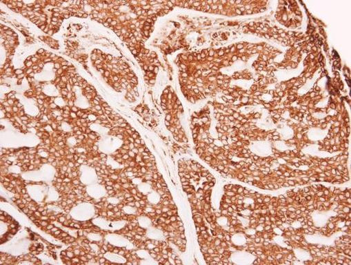 GANAB Antibody in Immunohistochemistry (Paraffin) (IHC (P))