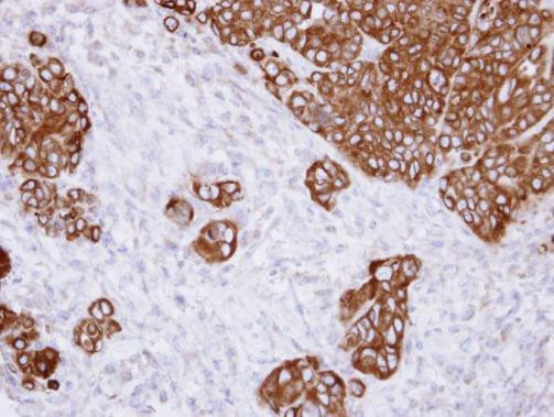 GANAB Antibody in Immunohistochemistry (Paraffin) (IHC (P))