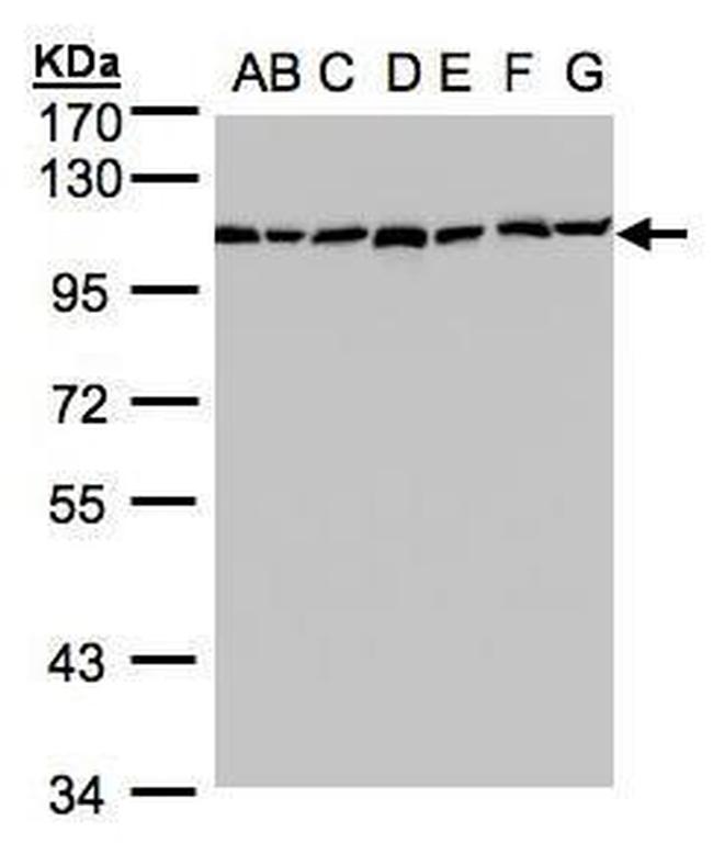 GANAB Antibody in Western Blot (WB)