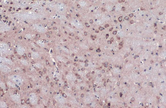 NUP62 Antibody in Immunohistochemistry (Paraffin) (IHC (P))