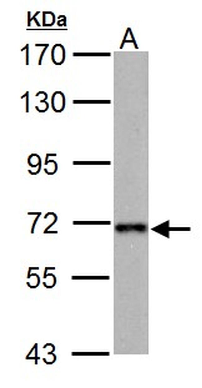 NUP62 Antibody in Western Blot (WB)