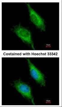 FASTK Antibody in Immunocytochemistry (ICC/IF)