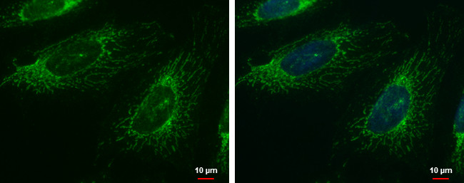 FASTK Antibody in Immunocytochemistry (ICC/IF)