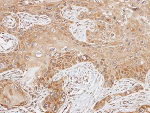 FASTK Antibody in Immunohistochemistry (Paraffin) (IHC (P))