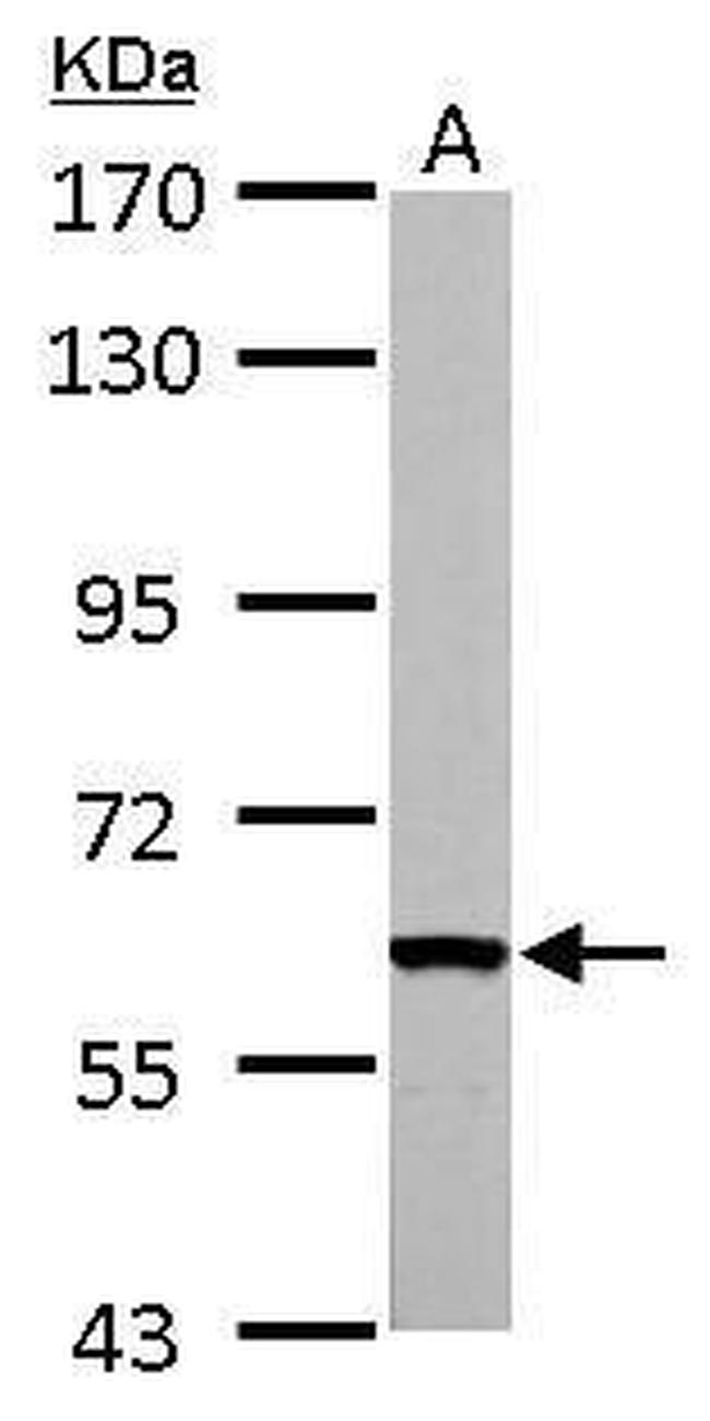 FASTK Antibody in Western Blot (WB)