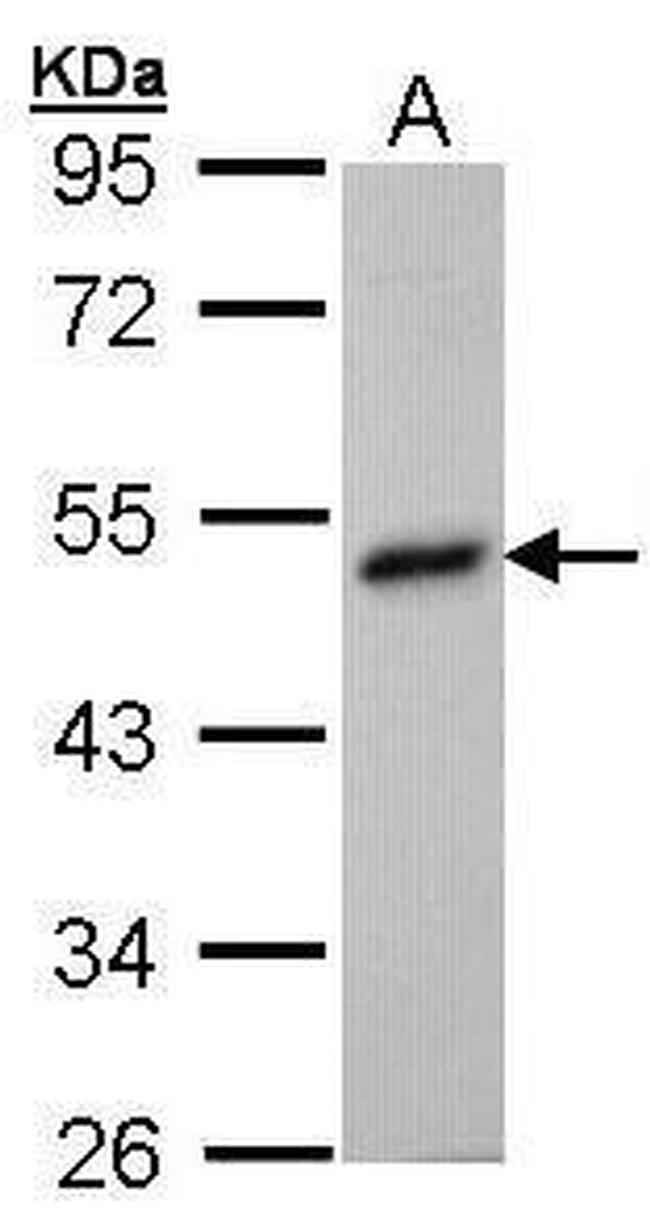 BHMT Antibody in Western Blot (WB)