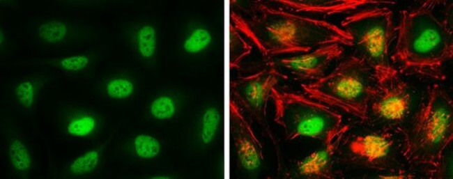 CAS Antibody in Immunocytochemistry (ICC/IF)