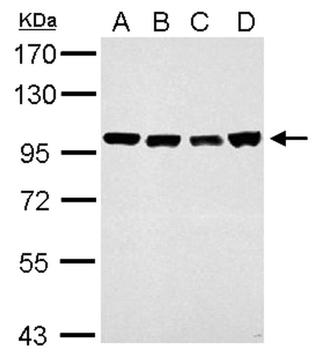 CAS Antibody in Western Blot (WB)