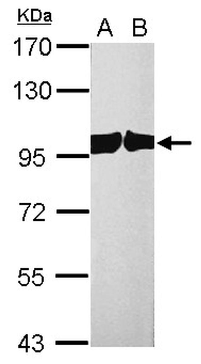 CAS Antibody in Western Blot (WB)