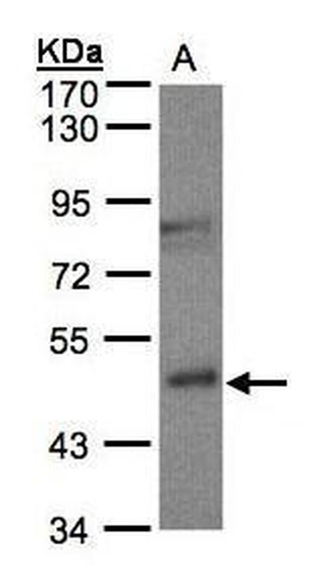 BBOX1 Antibody in Western Blot (WB)