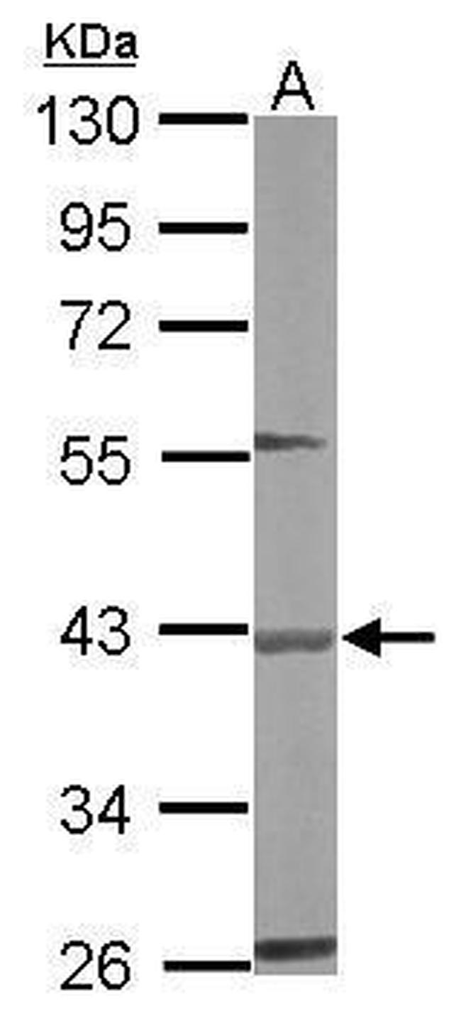 BBOX1 Antibody in Western Blot (WB)