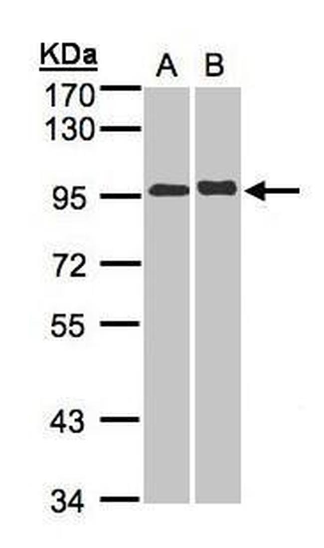 IL12RB2 Antibody in Western Blot (WB)