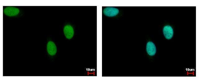 DNA Ligase III Antibody in Immunocytochemistry (ICC/IF)