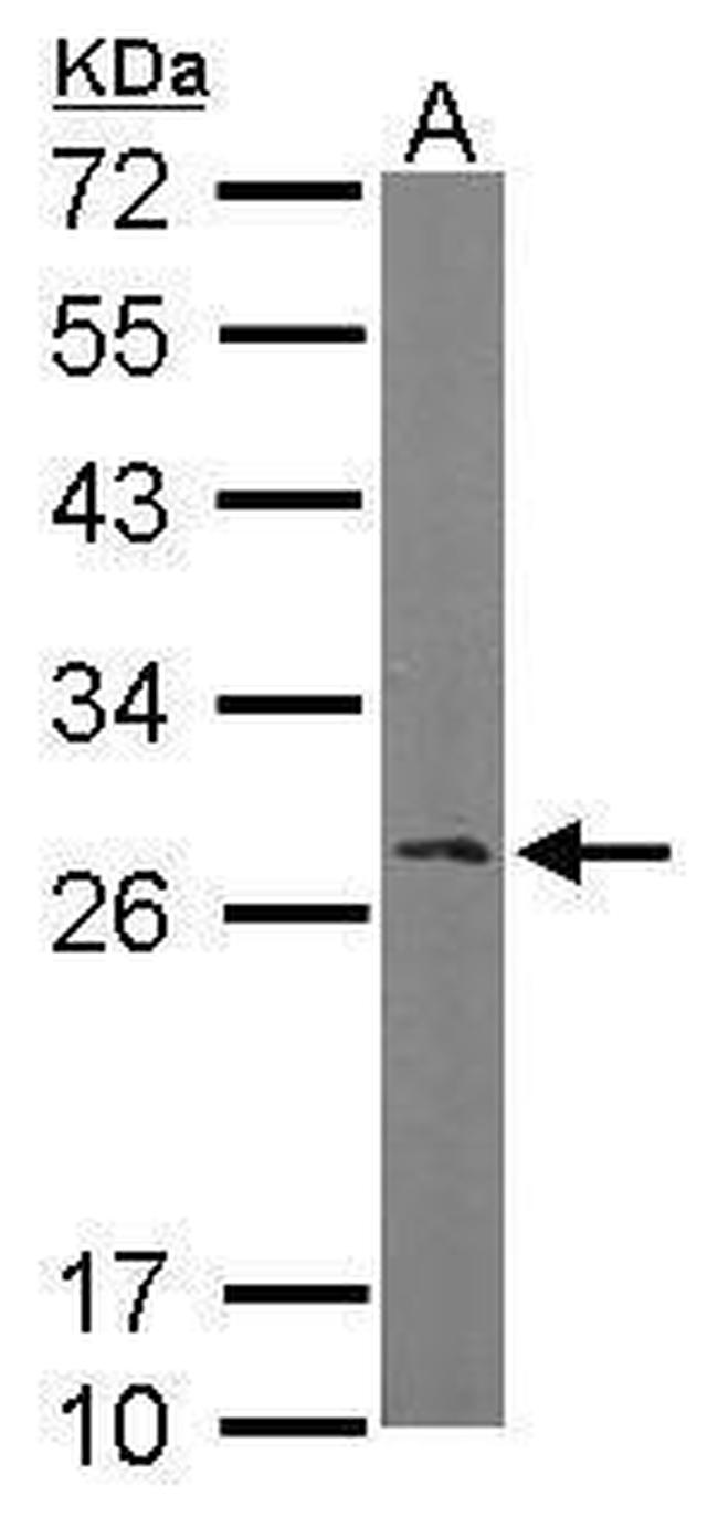 RANBP1 Antibody in Western Blot (WB)