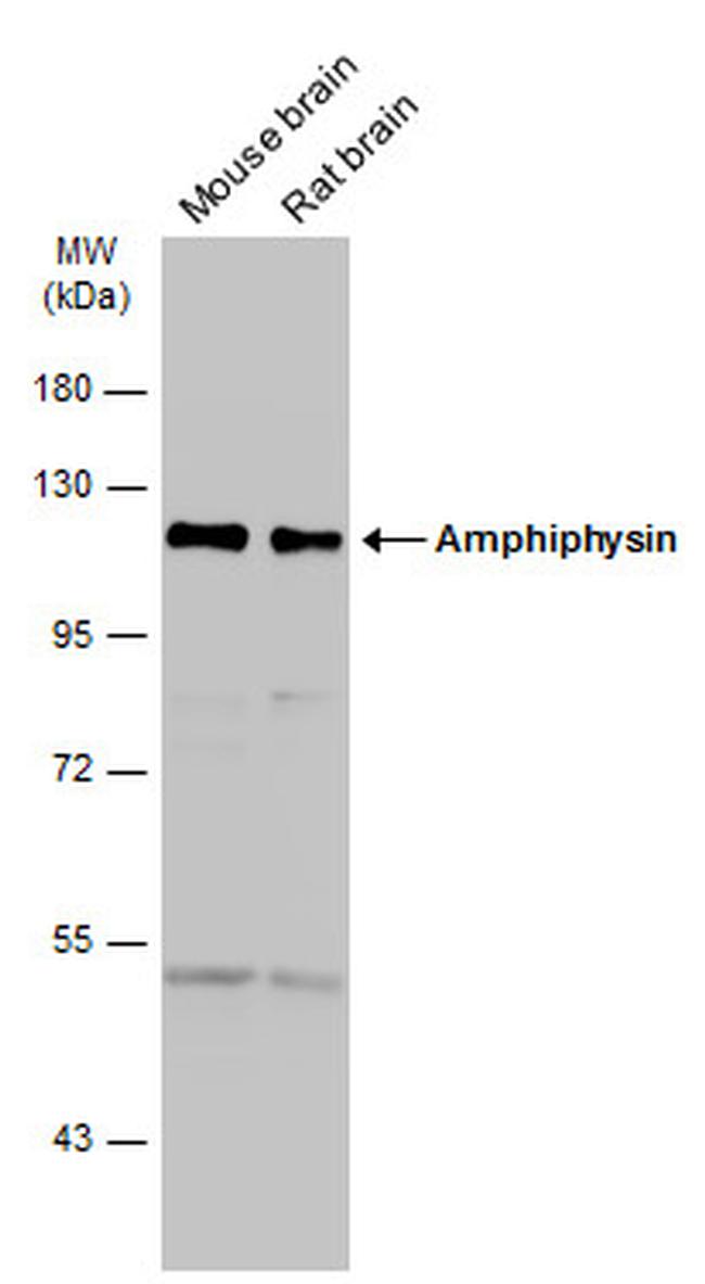 Amphiphysin Antibody in Western Blot (WB)