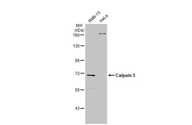 Calpain 5 Antibody in Western Blot (WB)