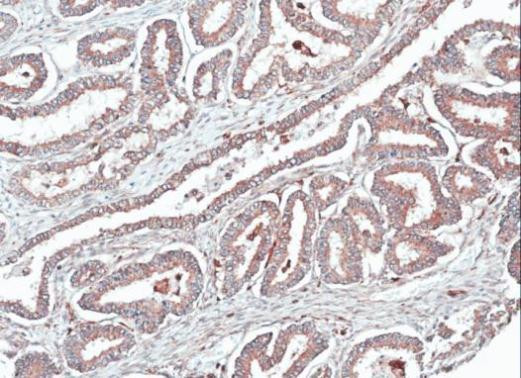 HOMER1 Antibody in Immunohistochemistry (Paraffin) (IHC (P))