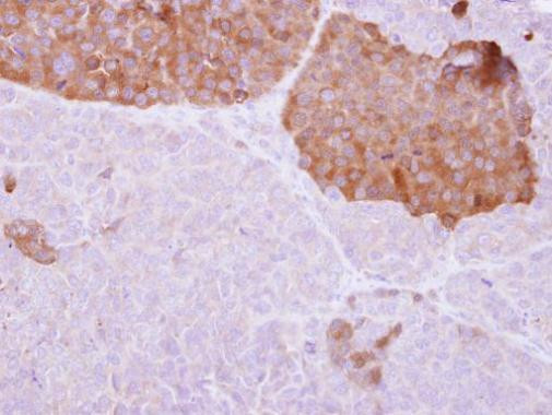 IL22RA2 Antibody in Immunohistochemistry (Paraffin) (IHC (P))