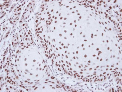 SART1 Antibody in Immunohistochemistry (Paraffin) (IHC (P))