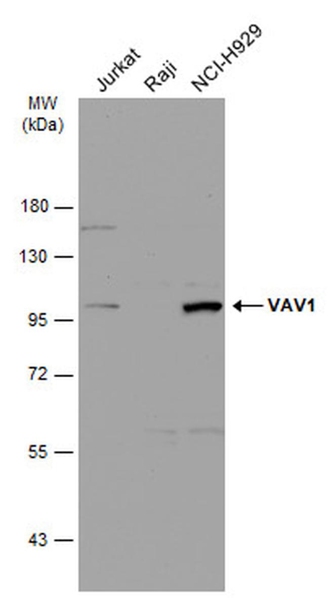 VAV1 Antibody in Western Blot (WB)