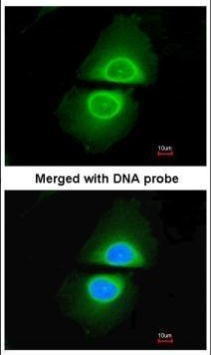 CYP4A11 Antibody in Immunocytochemistry (ICC/IF)