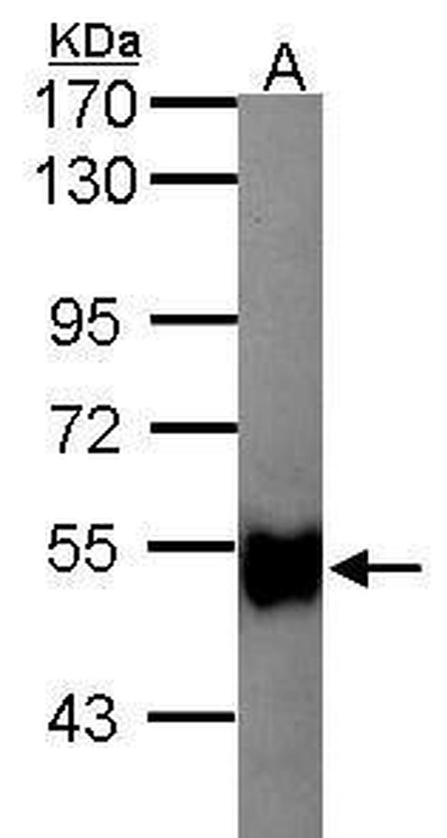 GK2 Antibody in Western Blot (WB)