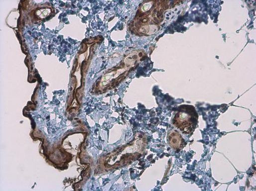 Kallikrein 7 Antibody in Immunohistochemistry (Paraffin) (IHC (P))