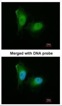 PSMA2 Antibody in Immunocytochemistry (ICC/IF)