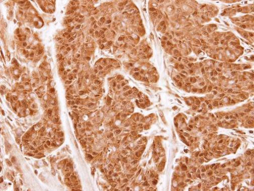 PSMA2 Antibody in Immunohistochemistry (Paraffin) (IHC (P))