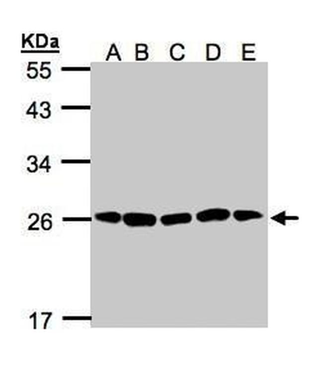 PSMA2 Antibody in Western Blot (WB)