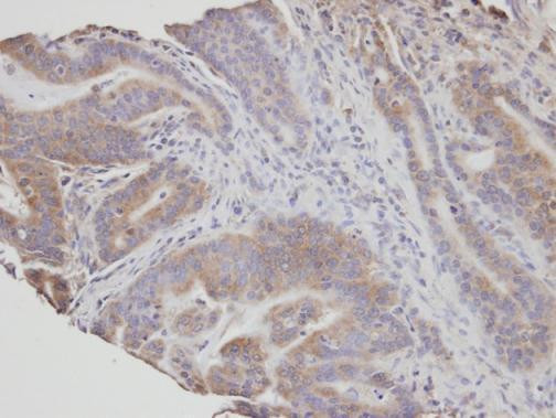 FAN Antibody in Immunohistochemistry (Paraffin) (IHC (P))