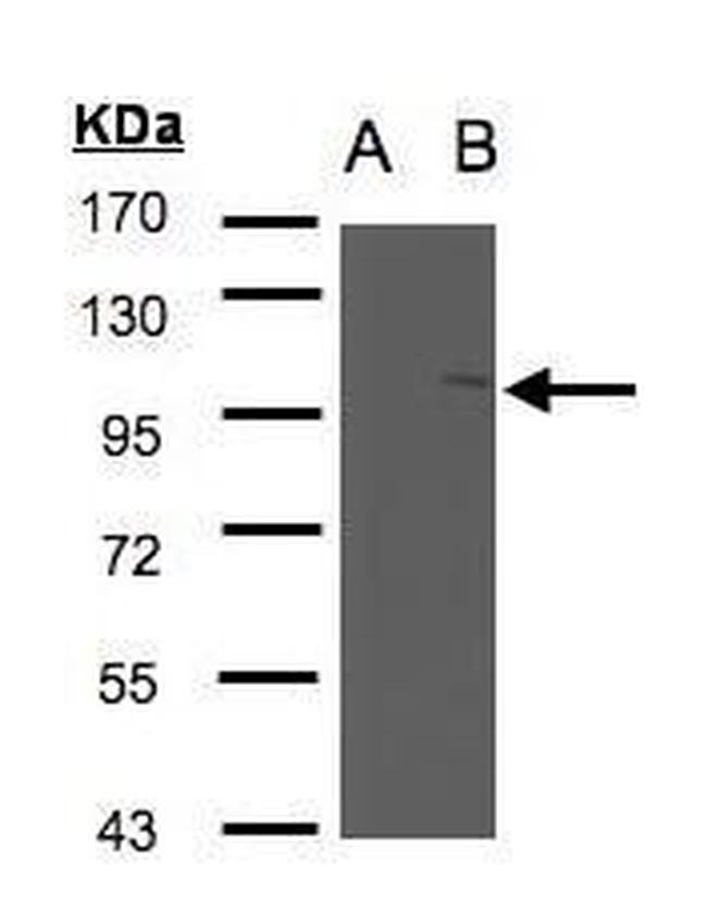 FAN Antibody in Western Blot (WB)