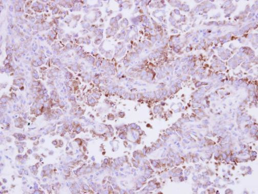 Laminin beta-3 Antibody in Immunohistochemistry (Paraffin) (IHC (P))