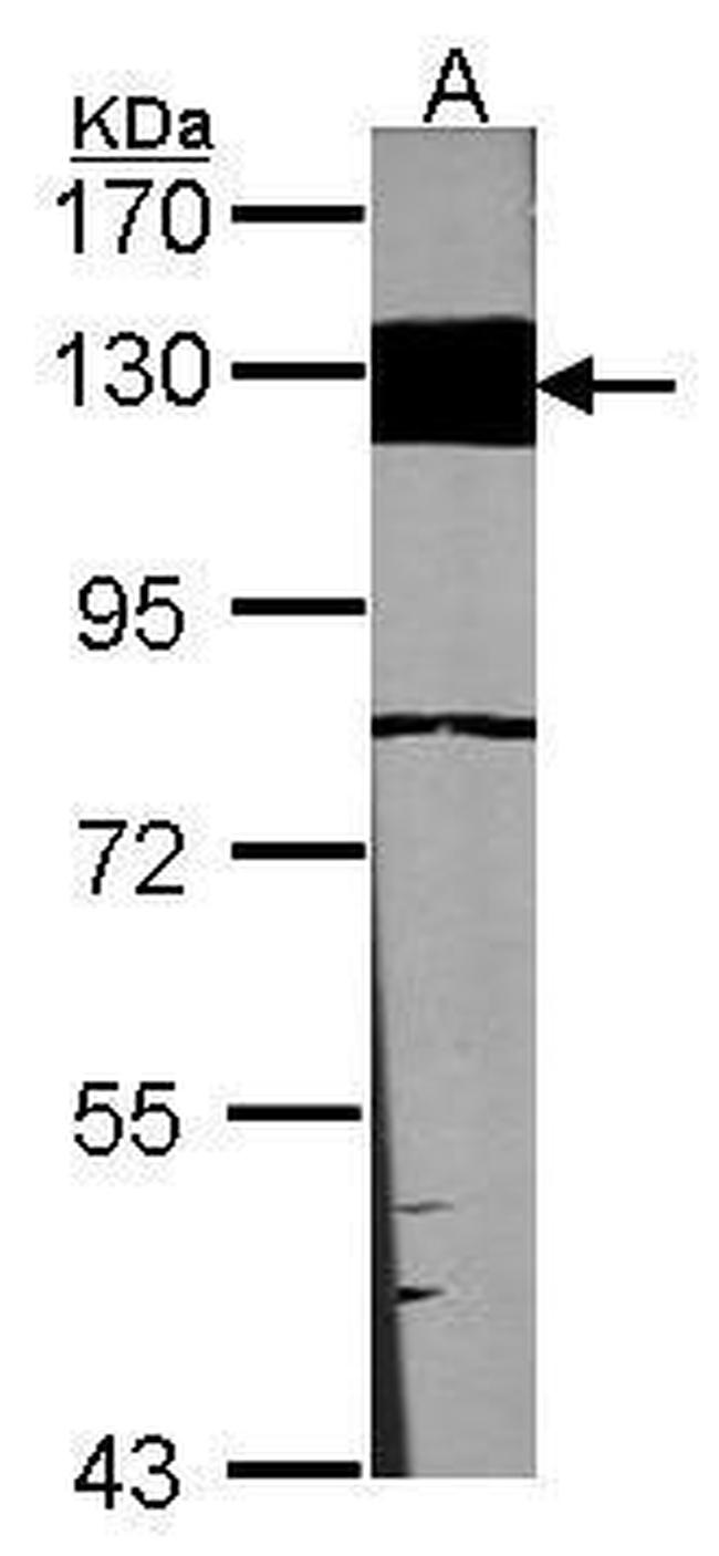 Laminin beta-3 Antibody in Western Blot (WB)