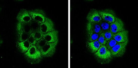 Laminin beta-3 Antibody in Immunocytochemistry (ICC/IF)