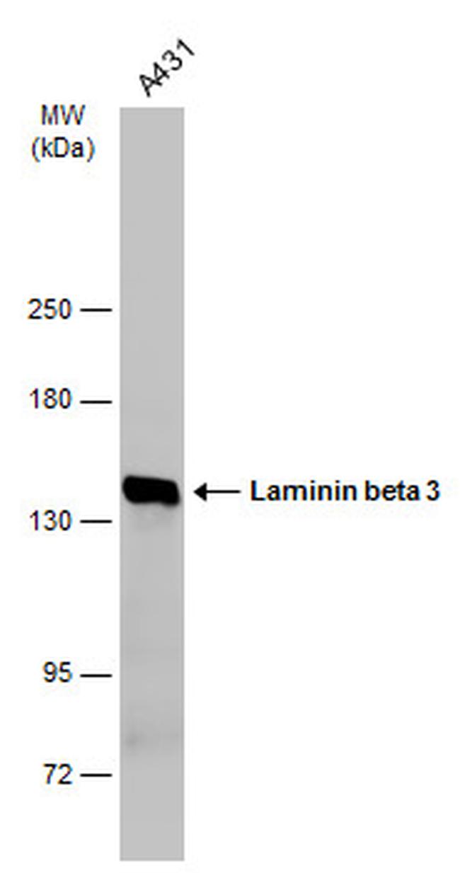 Laminin beta-3 Antibody in Western Blot (WB)