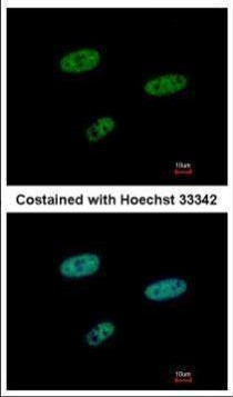 SAMHD1 Antibody in Immunocytochemistry (ICC/IF)