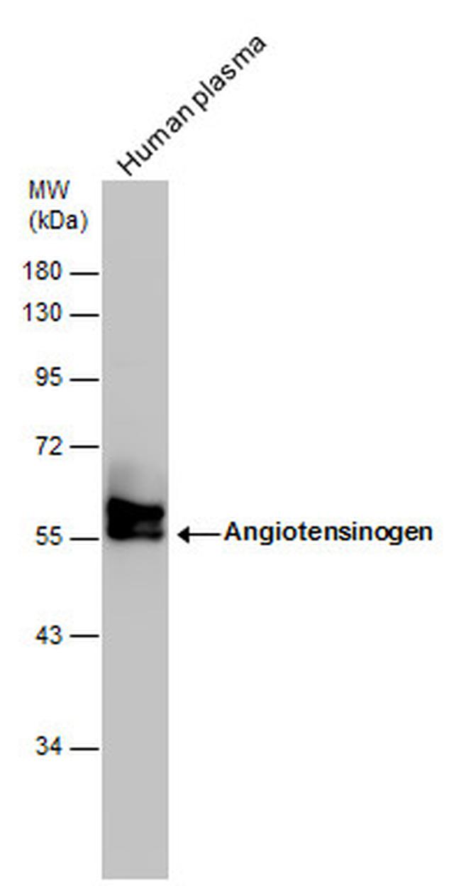 Angiotensinogen Antibody in Western Blot (WB)