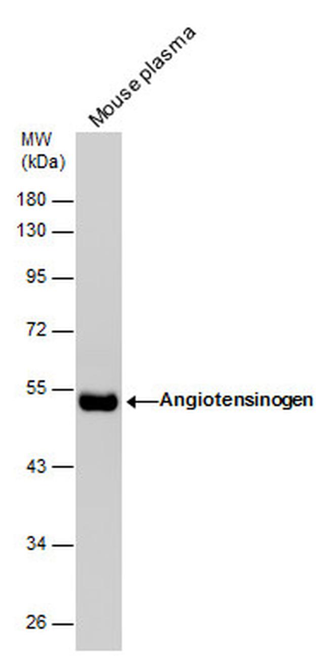 Angiotensinogen Antibody in Western Blot (WB)