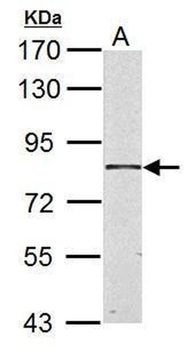 HSD17B4 Antibody in Western Blot (WB)