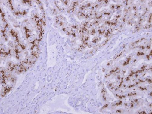 CLN2 Antibody in Immunohistochemistry (Paraffin) (IHC (P))