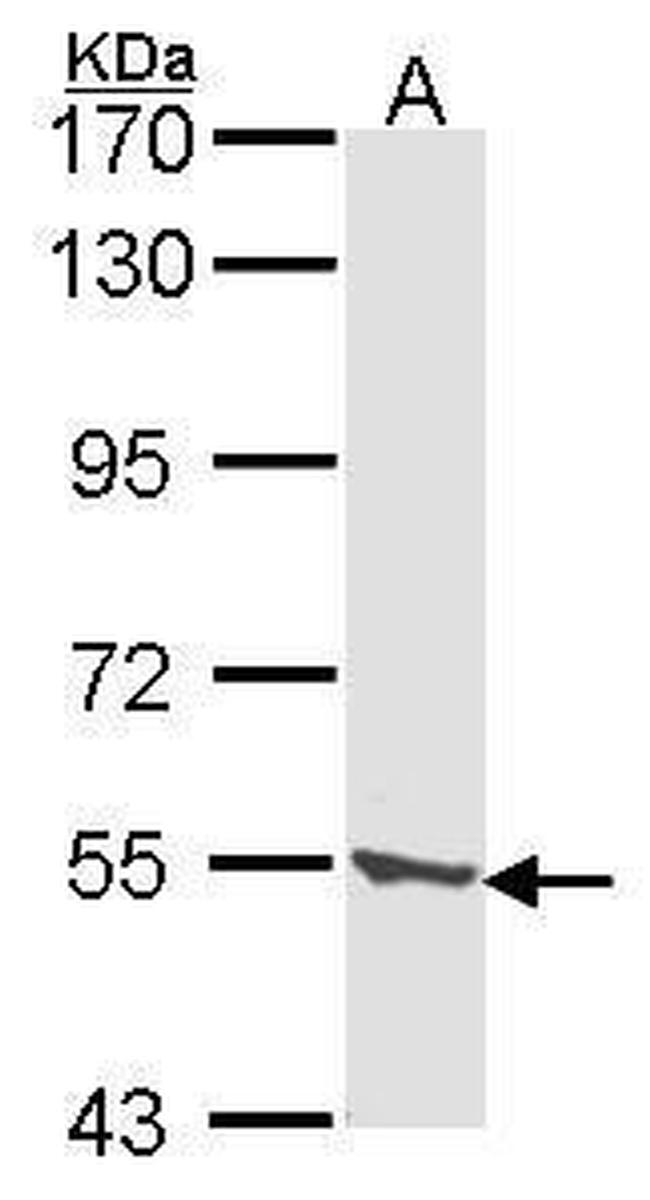 CLN2 Antibody in Western Blot (WB)