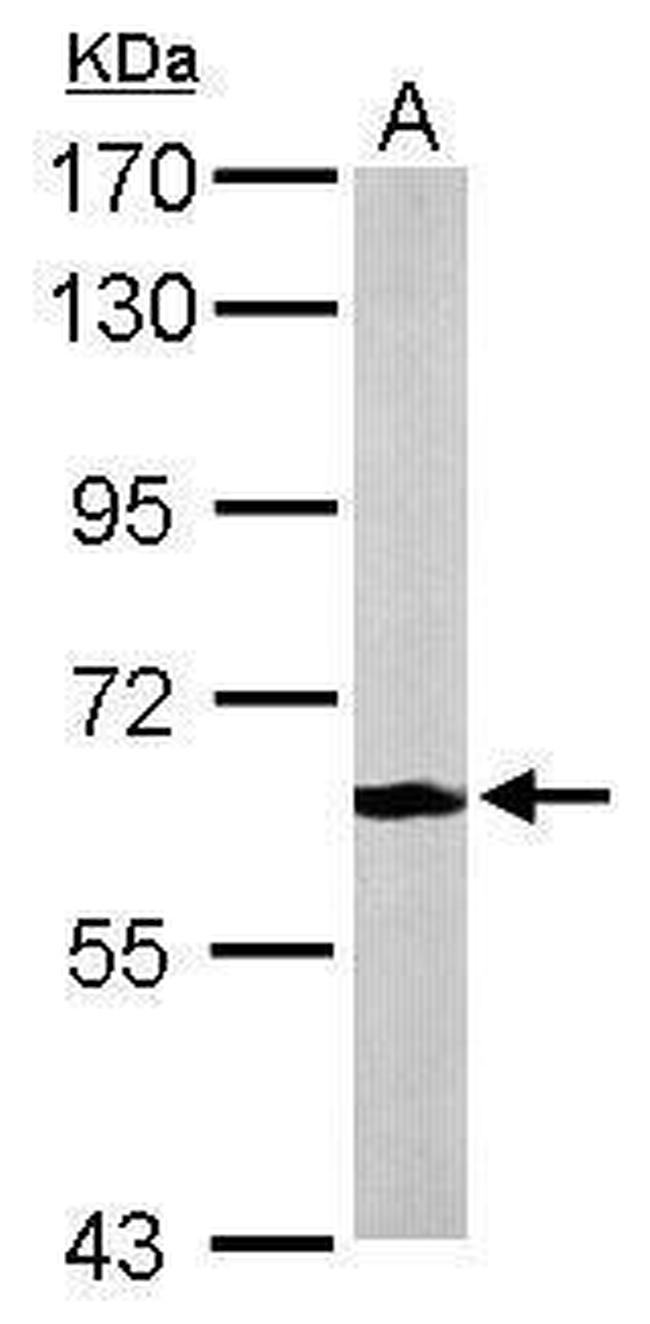 MPP2 Antibody in Western Blot (WB)