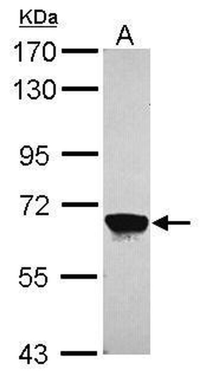 MPP2 Antibody in Western Blot (WB)