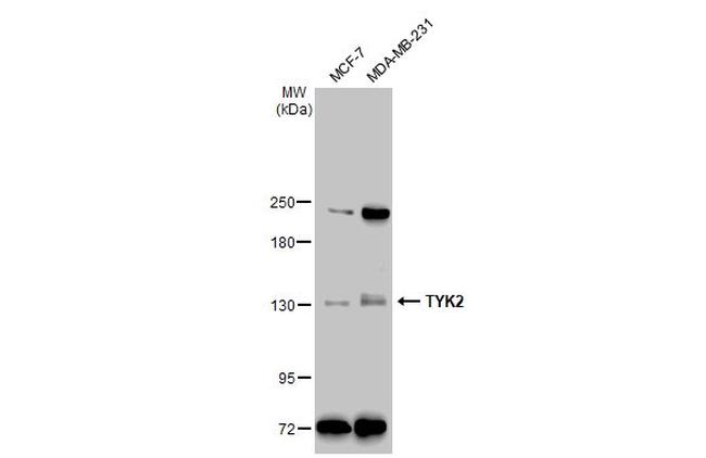 TYK2 Antibody in Western Blot (WB)