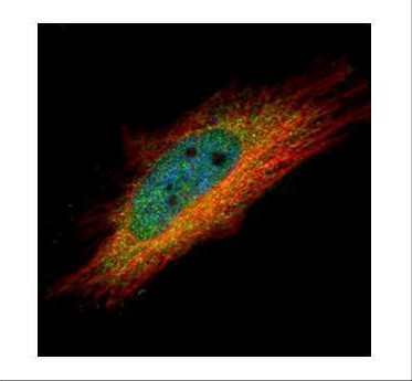 IP6K1 Antibody in Immunocytochemistry (ICC/IF)