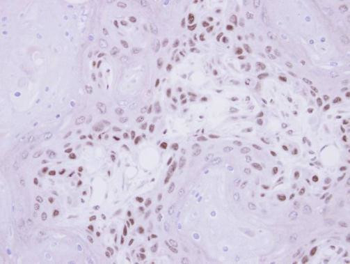 IP6K1 Antibody in Immunohistochemistry (Paraffin) (IHC (P))