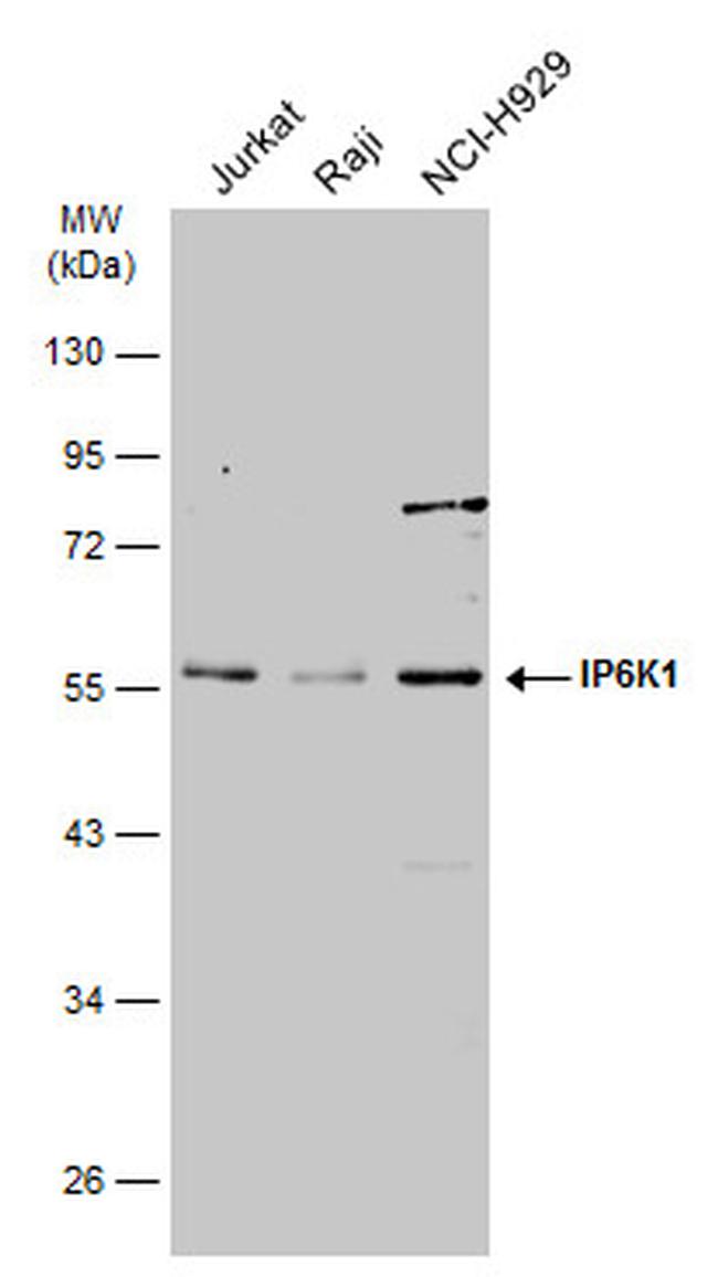 IP6K1 Antibody in Western Blot (WB)