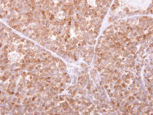 IFI30 Antibody in Immunohistochemistry (Paraffin) (IHC (P))